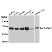 Western blot analysis of extracts of various cell lines, using ARHGAP1 antibody (abx002692) at 1/1000 dilution.