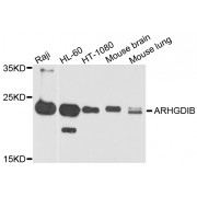 Western blot analysis of extracts of various cell lines, using ARHGDIB antibody (abx002693) at 1/1000 dilution.