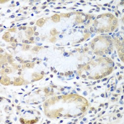 ATPase ASNA1 (ASNA1) Antibody