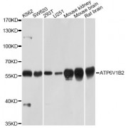 Western blot analysis of extracts of various cell lines, using ATP6V1B2 Antibody (abx002706) at 1/1000 dilution.