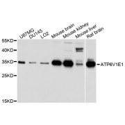 Western blot analysis of extracts of various cell lines, using ATP6V1E1 antibody (abx002708) at 1/1000 dilution.
