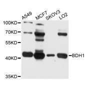 Western blot analysis of extracts of various cell lines, using BDH1 antibody (abx002715) at 1/1000 dilution.