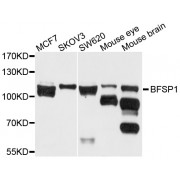 Western blot analysis of extracts of various cell lines, using BFSP1 antibody (abx002716) at 1/1000 dilution.