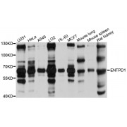 Western blot analysis of extracts of various cell lines, using ENTPD1 antibody (abx002729) at 1/1000 dilution.