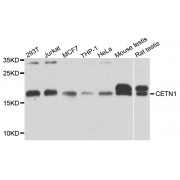 Western blot analysis of extracts of various cell lines, using CETN1 antibody (abx002735) at 1/1000 dilution.