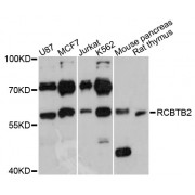 Western blot analysis of extracts of various cell lines, using RCBTB2 antibody (abx002736) at 1:3000 dilution.