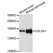 Western blot analysis of extracts of various cell lines, using COL3A1 antibody (abx002746) at 1/1000 dilution.