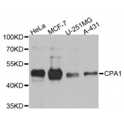 Western blot analysis of extracts of various cell lines, using CPA1 antibody (abx002754) at 1/1000 dilution.