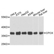 Western blot analysis of extracts of various cell lines, using CPOX antibody (abx002758) at 1/1000 dilution.