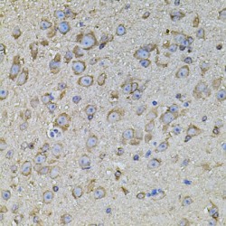 Coproporphyrinogen Oxidase (CPOX) Antibody