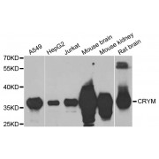 Western blot analysis of extracts of various cell lines, using CRYM antibody (abx002761) at 1/1000 dilution.