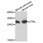 Western blot analysis of extracts of various cell lines, using CTRL antibody (abx002768) at 1/1000 dilution.