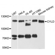 Western blot analysis of extracts of various cell lines, using CYLD antibody (abx002771) at 1/1000 dilution.