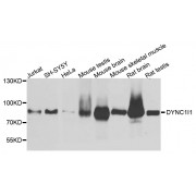 Western blot analysis of extracts of various cell lines, using DYNC1I1 antibody (abx002782) at 1/1000 dilution.