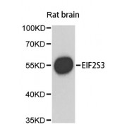 Western blot analysis of extracts of rat brain, using EIF2S3 antibody (abx002795) at 1/1000 dilution.