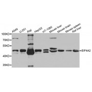 Western blot analysis of extracts of various cell lines, using EIF4A2 antibody (abx002796) at 1/1000 dilution.