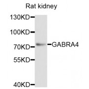 Western blot analysis of extracts of rat kidney, using GABRA4 antibody (abx002817) at 1/1000 dilution.