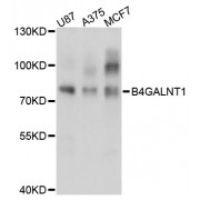 Western blot analysis of extracts of various cell lines, using B4GALNT1 antibody (abx002820) at 1:3000 dilution.