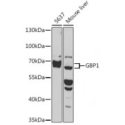 Western blot analysis of extracts of various cell lines, using GBP1 antibody (abx002824) at 1/1000 dilution.