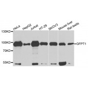 Western blot analysis of extracts of various cell lines, using GFPT1 antibody (abx002827) at 1/1000 dilution.