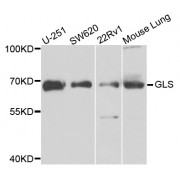 Western blot analysis of extracts of various cell lines, using GLS antibody (abx002829) at 1/1000 dilution.