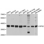 Western blot analysis of extracts of various cell lines, using GPS2 antibody (abx002842) at 1:3000 dilution.