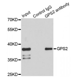 G Protein Pathway Suppressor 2 (GPS2) Antibody