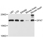 Western blot analysis of extracts of various cell lines, using GPX7 antibody (abx002843) at 1/1000 dilution.
