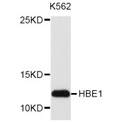 Western blot analysis of extracts of K-562 cells, using HBE1 antibody (abx002850) at 1/1000 dilution.
