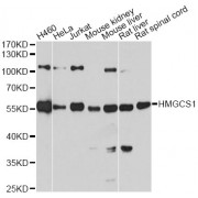 Western blot analysis of extracts of various cell lines, using HMGCS1 antibody (abx002857) at 1:7000 dilution.