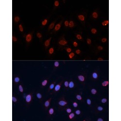 Heterogeneous Nuclear Ribonucleoprotein U (HNRNPU) Antibody