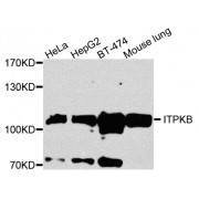 Western blot analysis of extracts of various cell lines, using ITPKB antibody (abx002869) at 1/1000 dilution.