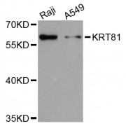 Western blot analysis of extracts of various cell lines, using KRT81 antibody (abx002879) at 1:3000 dilution.