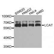 Western blot analysis of extracts of various cell lines, using LCAT antibody (abx002881) at 1/1000 dilution.