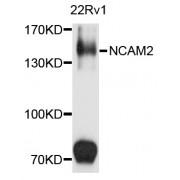 Western blot analysis of extracts of 22Rv1 cells, using NCAM2 antibody (abx002910) at 1/1000 dilution.
