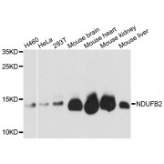 Western blot analysis of extracts of various cell lines, using NDUFB2 antibody (abx002913) at 1:3000 dilution.