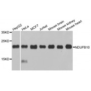 Western blot analysis of extracts of various cell lines, using NDUFB10 antibody (abx002917) at 1/1000 dilution.