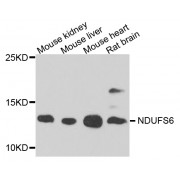 Western blot analysis of extracts of various cell lines, using NDUFS6 antibody (abx002920) at 1/1000 dilution.