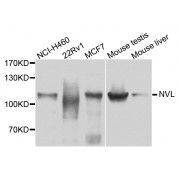 Western blot analysis of extracts of various cell lines, using NVL antibody (abx002929) at 1/1000 dilution.