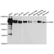 Western blot analysis of extracts of various cell lines, using OSBP antibody (abx002931) at 1/1000 dilution.