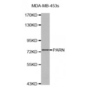 Western blot analysis of extracts of MDA-MB-453s cells, using PARN antibody (abx002935).