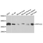 Western blot analysis of extracts of various cell lines, using PPP1CC antibody (abx002960) at 1/1000 dilution.