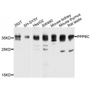 Western blot analysis of extracts of various cell lines, using PPP6C antibody (abx002964) at 1/1000 dilution.