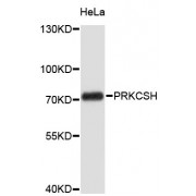 Western blot analysis of extracts of HeLa cells, using PRKCSH antibody (abx002970).