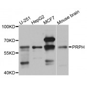 Western blot analysis of extracts of various cell lines, using PRPH antibody (abx002973) at 1/1000 dilution.