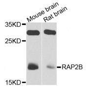 Western blot analysis of extracts of various cell lines, using RAP2B antibody (abx002992) at 1/1000 dilution.