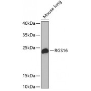 Western blot analysis of extracts of mouse lung, using RGS16 antibody (abx002999) at 1/1000 dilution.