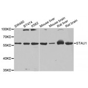 Western blot analysis of extracts of various cell lines, using STAU1 antibody (abx003045) at 1/1000 dilution.