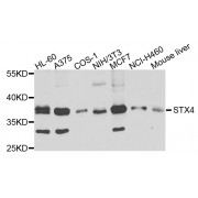 Western blot analysis of extracts of various cell lines, using STX4 antibody (abx003047) at 1/1000 dilution.