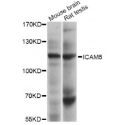 Western blot analysis of extracts of various cell lines, using ICAM5 Antibody (abx003070) at 1/1000 dilution.